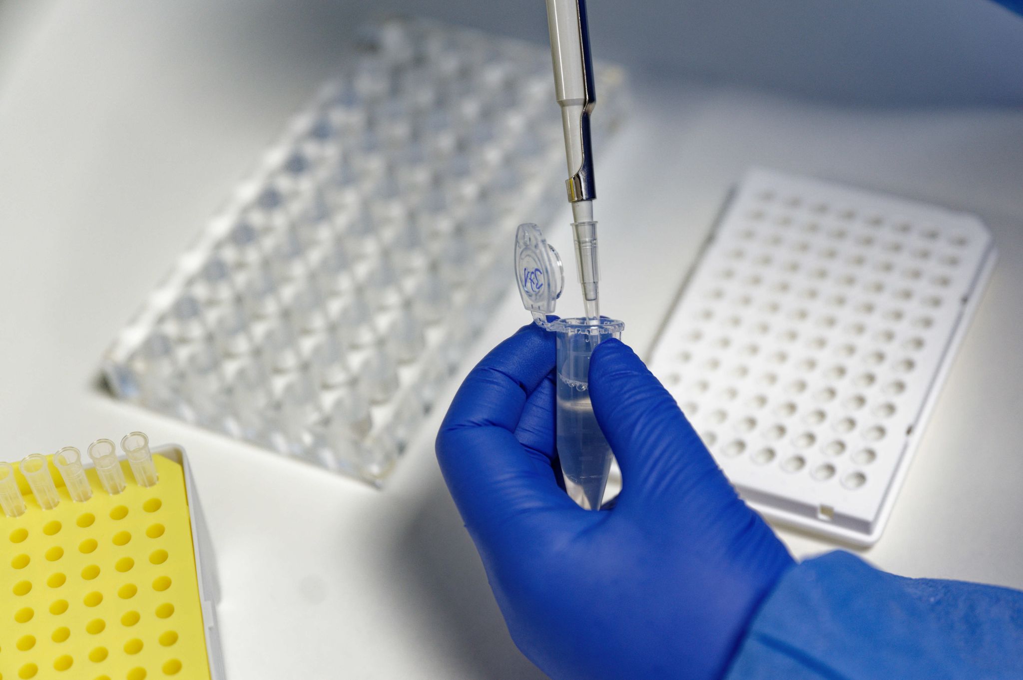Coronavirus – PCR-Test
