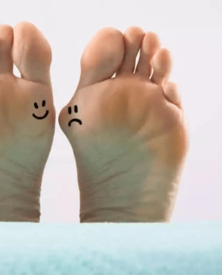 Wie man Hallux Valgus vermeidet