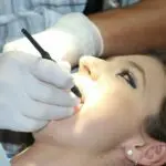 Warum die Prophylaxe beim Zahnarzt trotz regelmäßigem Zähne putzen essentiell ist
