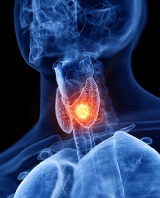 Neue Erkenntnisse zu Schilddrüsenstörungen verändern Verständnis