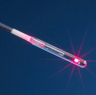 biolitec Lasersystem LEONARDO DUAL zeigt sehr gute Ergebnisse mit radialer FiLaC-Laserfaser bei Akne inversa und Steißbeinfisteln